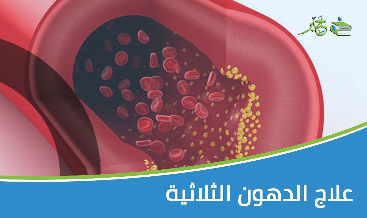 علاج الدهون الثلاثية