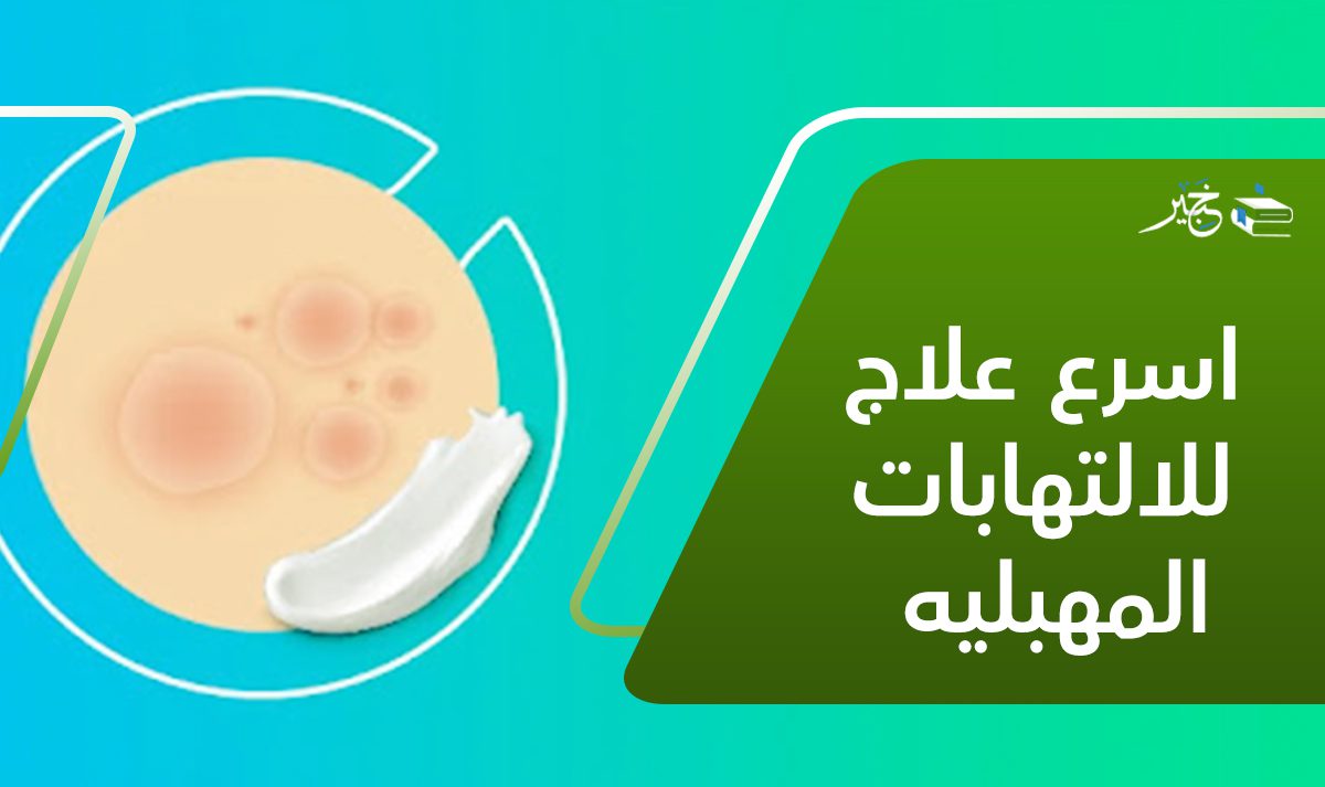 اسرع علاج للالتهابات المهبليه